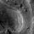 Melas Chasma Deposits